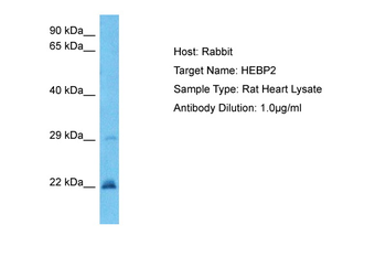 Hebp2 Rabbit Polyclonal Antibody
