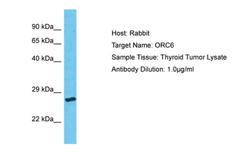 ORC6 Rabbit Polyclonal Antibody