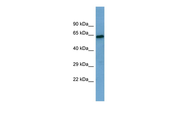 SESN1 Rabbit Polyclonal Antibody