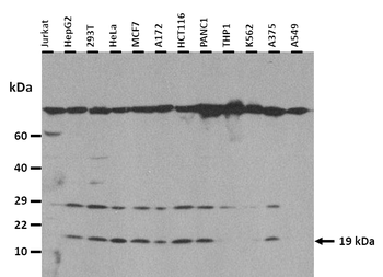 OBP2A Rabbit Polyclonal Antibody