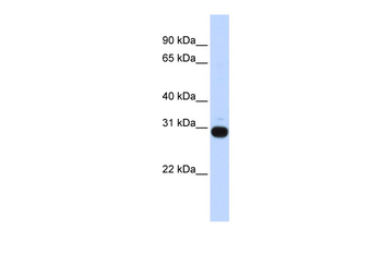 VASH1 Rabbit Polyclonal Antibody