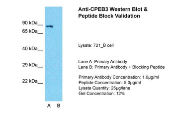 CPEB3 Rabbit Polyclonal Antibody