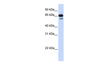 R3HDM2 Rabbit Polyclonal Antibody
