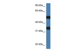 Arsg Rabbit Polyclonal Antibody