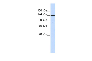 DAAM1 Rabbit Polyclonal Antibody
