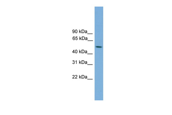 STK38L Rabbit Polyclonal Antibody