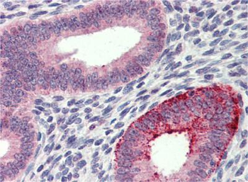 FCHO1 Rabbit Polyclonal Antibody