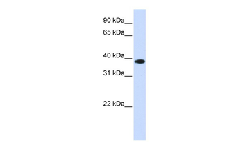 GPD1L Rabbit Polyclonal Antibody