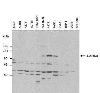 SMG5 Rabbit Polyclonal Antibody