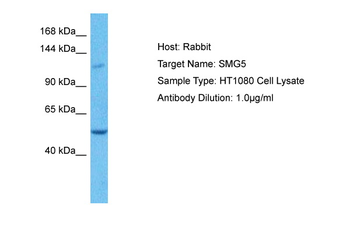 SMG5 Rabbit Polyclonal Antibody