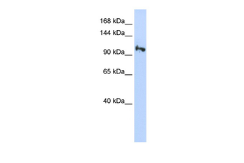 SMG5 Rabbit Polyclonal Antibody