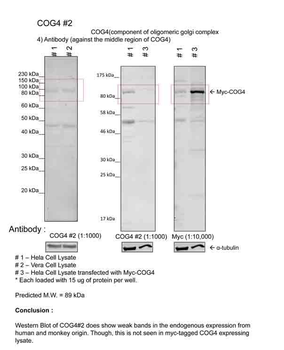 COG4 Rabbit Polyclonal Antibody