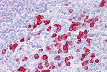 TKFC Rabbit Polyclonal Antibody