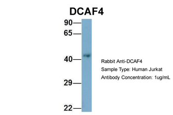 WDR21A Rabbit Polyclonal Antibody
