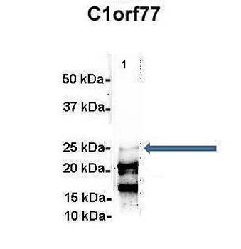 C1orf77 Rabbit Polyclonal Antibody