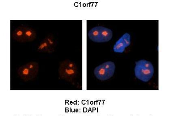 C1orf77 Rabbit Polyclonal Antibody