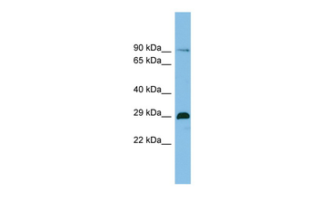 C1orf77 Rabbit Polyclonal Antibody