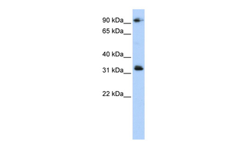 CCDC69 Rabbit Polyclonal Antibody