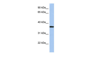 LDLRAP1 Rabbit Polyclonal Antibody