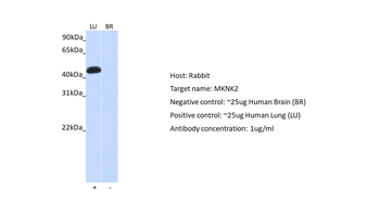 MKNK2 Rabbit Polyclonal Antibody