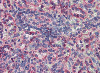 MKNK2 Rabbit Polyclonal Antibody