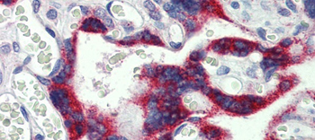 MKNK2 Rabbit Polyclonal Antibody