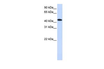 MKNK2 Rabbit Polyclonal Antibody