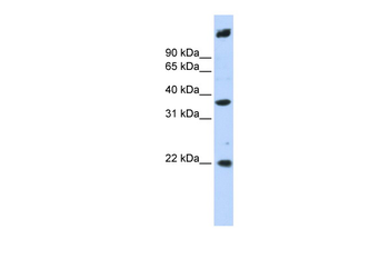SSBP3 Rabbit Polyclonal Antibody