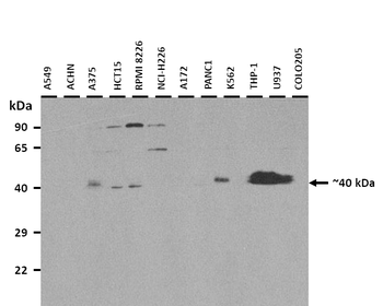 SSBP3 Rabbit Polyclonal Antibody