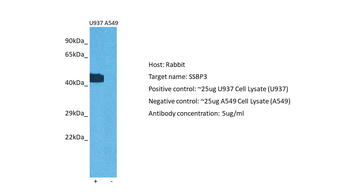 SSBP3 Rabbit Polyclonal Antibody