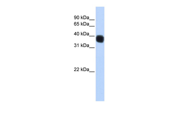 SSBP3 Rabbit Polyclonal Antibody