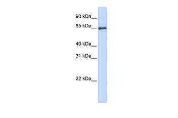 HSPA2 Rabbit Polyclonal Antibody