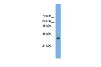 FAM78A Rabbit Polyclonal Antibody