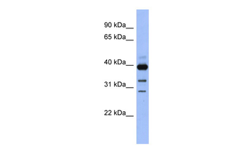 GNAO1 Rabbit Polyclonal Antibody