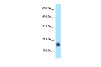 JCHAIN Rabbit Polyclonal Antibody