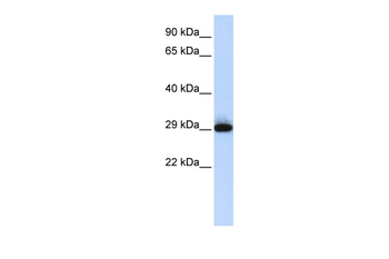 SUSD3 Rabbit Polyclonal Antibody
