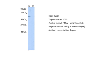 CFAP53 Rabbit Polyclonal Antibody