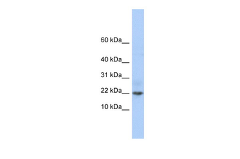C9orf25 Rabbit Polyclonal Antibody