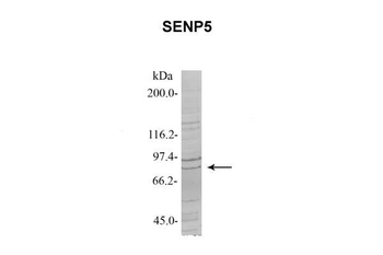 SENP5 Rabbit Polyclonal Antibody