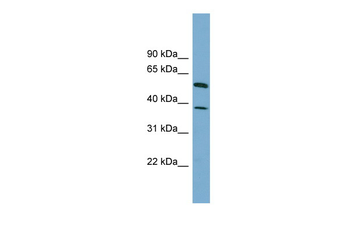 HEPACAM Rabbit Polyclonal Antibody