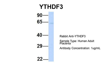 YTHDF3 Rabbit Polyclonal Antibody