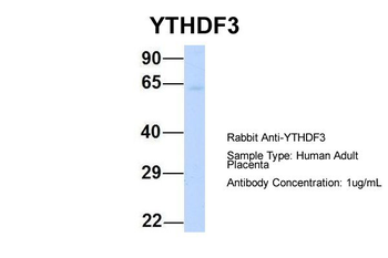 YTHDF3 Rabbit Polyclonal Antibody