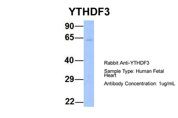 YTHDF3 Rabbit Polyclonal Antibody