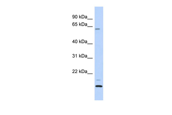 TCP11L2 Rabbit Polyclonal Antibody