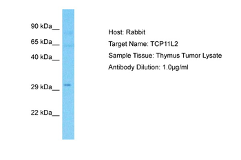 TCP11L2 Rabbit Polyclonal Antibody