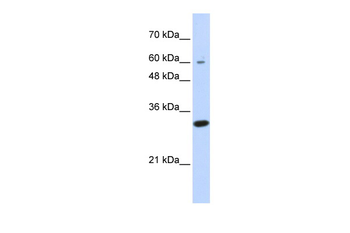 LRRC57 Rabbit Polyclonal Antibody