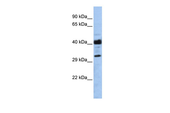 LRRC57 Rabbit Polyclonal Antibody