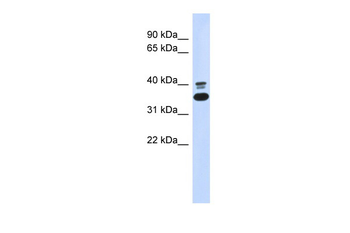 ABHD7 Rabbit Polyclonal Antibody