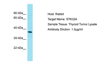 STK32A Rabbit Polyclonal Antibody