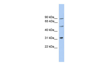 C6orf182 Rabbit Polyclonal Antibody